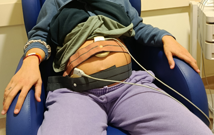 CTG no Trabalho de Parto: Uma Ferramenta, Não um Diagnóstico